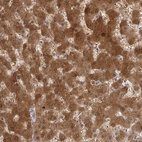 Immunohistochemical staining of human liver shows strong cytoplasmic positivity in hepatocytes.