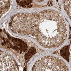 Immunohistochemical staining of human testis shows strong cytoplasmic positivity in Leydig cells.