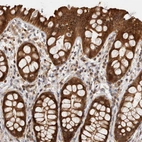 Immunohistochemical staining of human rectum shows strong cytoplasmic positivity in glandular cells.