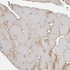 Immunohistochemical staining of human skeletal muscle shows no positivity in myocytes as expected.