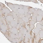 Immunohistochemical staining of human skeletal muscle shows no positivity in myocytes as expected.