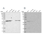 Western blot analysis using Anti-ACAT2 antibody HPA025765 (A) shows similar pattern to independent antibody HPA025811 (B).