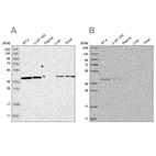 Western blot analysis using Anti-ACAT2 antibody HPA025765 (A) shows similar pattern to independent antibody HPA025811 (B).