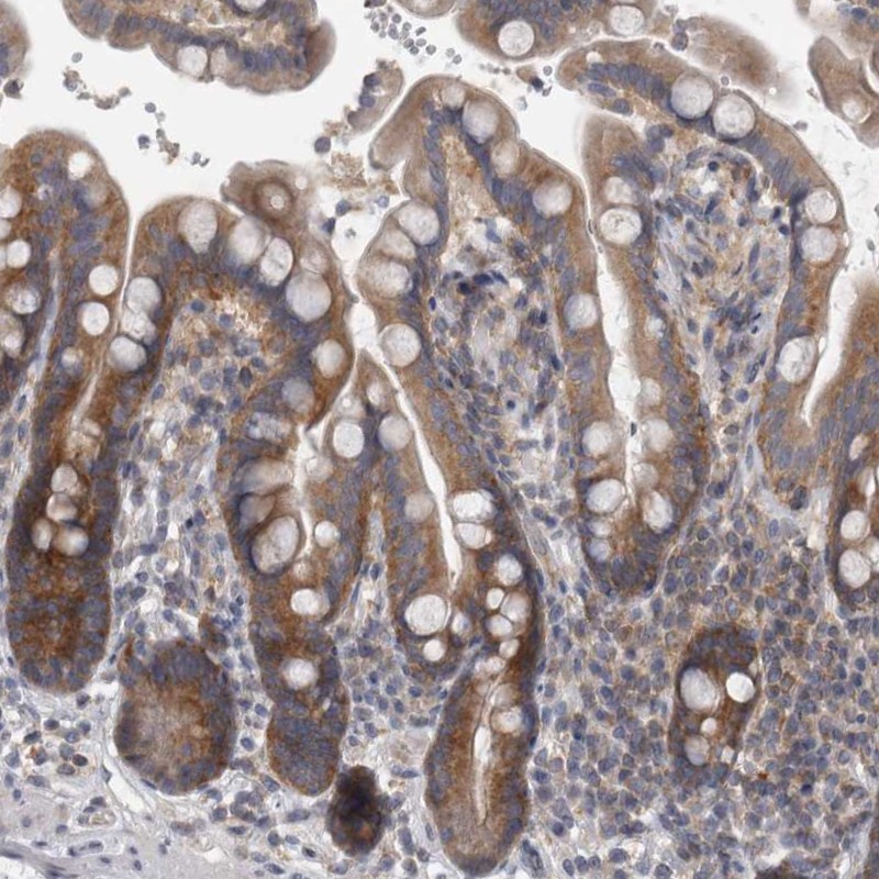 Anti-PRRC2C Antibody