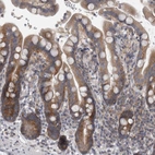 Anti-PRRC2C Antibody