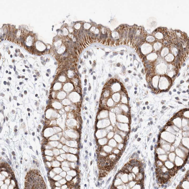 Anti-MRPL37 Antibody