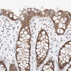 Anti-MRPL37 Antibody