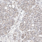 Immunohistochemical staining of human pancreas shows weak granular cytoplasmic positivity in exocrine glandular cells.