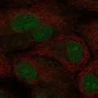Anti-TCF21 Antibody