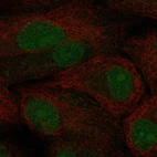 Anti-TCF21 Antibody