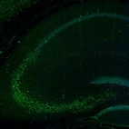 Immunofluorescence staining of mouse hippocampus shows neuronal immunoreactivity in the CA3 layer.