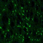 Immunofluorescence staining of mouse globus pallidus shows immunoreactivity in neurons.
