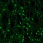 Immunofluorescence staining of mouse globus pallidus shows immunoreactivity in neurons.