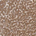 Anti-FH Antibody