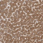 Immunohistochemical staining of human liver shows strong granular cytoplasmic positivity in hepatocytes.