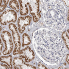 Anti-FH Antibody