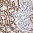 Immunohistochemical staining of human kidney shows strong granular cytoplasmic positivity in cells in tubules.