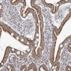 Immunohistochemical staining of human duodenum shows strong granular cytoplasmic positivity in glandular cells.