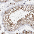 Anti-FH Antibody