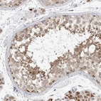 Immunohistochemical staining of human testis shows moderate granular cytoplasmic positivity in cells in seminiferous ducts.