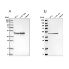 Anti-FH Antibody