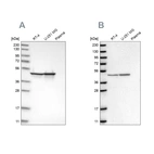 Western blot analysis using Anti-FH antibody HPA025770 (A) shows similar pattern to independent antibody HPA027341 (B).