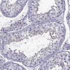 Immunohistochemical staining of human testis shows high expression.