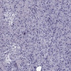 Anti-ARMC2 Antibody