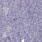 Immunohistochemical staining of human pancreas shows low expression as expected.