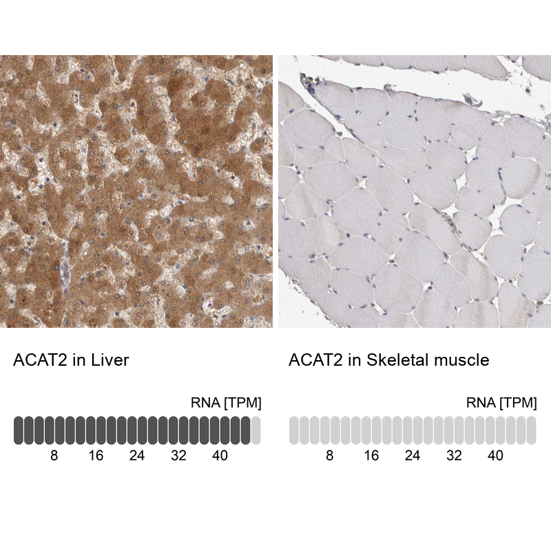 Anti-ACAT2 Antibody