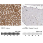 Anti-ACAT2 Antibody