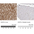 Anti-ACAT2 Antibody