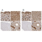 Immunohistochemical staining of human gastrointestinal, liver, skeletal muscle and testis using Anti-ACAT2 antibody HPA025811 (A) shows similar protein distribution across tissues to independent antibody HPA025736 (B).