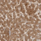 Immunohistochemical staining of human liver shows strong cytoplasmic positivity in hepatocytes.