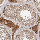 Immunohistochemical staining of human testis shows strong cytoplasmic positivity in Leydig cells.