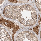 Immunohistochemical staining of human testis shows strong cytoplasmic positivity in Leydig cells.