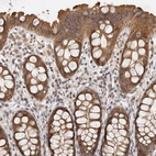 Immunohistochemical staining of human rectum shows strong cytoplasmic positivity in glandular cells.