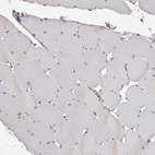 Immunohistochemical staining of human skeletal muscle shows no positivity in myocytes as expected.