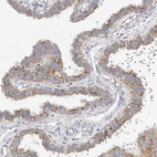 Anti-ELP3 Antibody