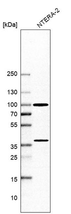Western blot analysis in human cell line NTERA-2.