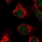 Anti-XRCC5 Antibody