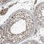 Anti-ZNF345 Antibody