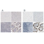 Immunohistochemical staining of human cerebral cortex, liver, lymph node and small intestine using Anti-ZBTB7B antibody HPA025820 (A) shows similar protein distribution across tissues to independent antibody HPA006811 (B).