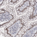 Immunohistochemical staining of human small intestine shows moderate nuclear positivity in glandular cells.