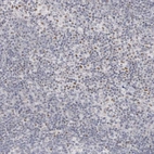 Immunohistochemical staining of human lymph node shows moderate nuclear positivity in a subset of non-germinal center cells.