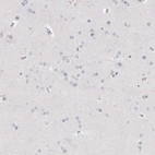 Immunohistochemical staining of human cerebral cortex shows no positivity in neurons as expected.
