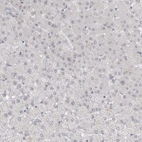 Immunohistochemical staining of human liver shows no positivity in hepatocytes as expected.