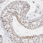 Anti-RECQL4 Antibody