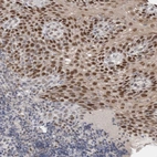 Immunohistochemical staining of human tonsil shows strong nuclear positivity in squamous epithelial cells.