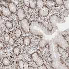 Immunohistochemical staining of human stomach shows strong nuclear positivity in glandular cells.